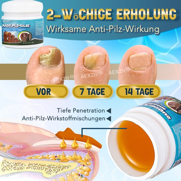 Aexzr® 5X Schnell heilende Nagelpilzsalbe