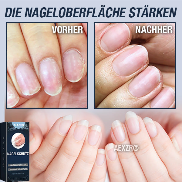 AEXZR® Nagelreparatur-Serum